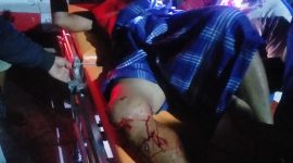 Mukholik (60) Petambak Bumi Dipasena Jaya, Rawajitu Lampung alami Luka Serius Akibat Diserang Buaya(11/6) Suarautama.id